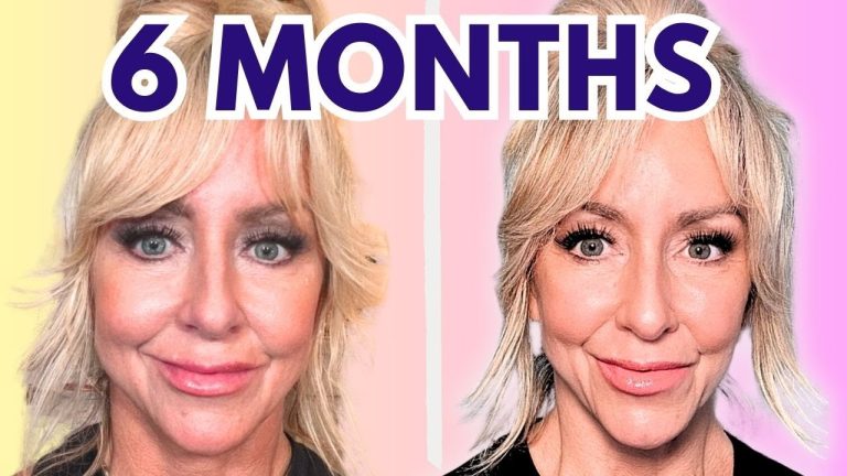 Doctor Reveals MUST TAKE Supplements /Skincare to Reduce Wrinkles