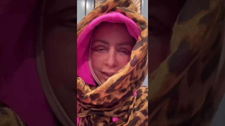 No More Secrets… Here’s My Entire Facelift Journey