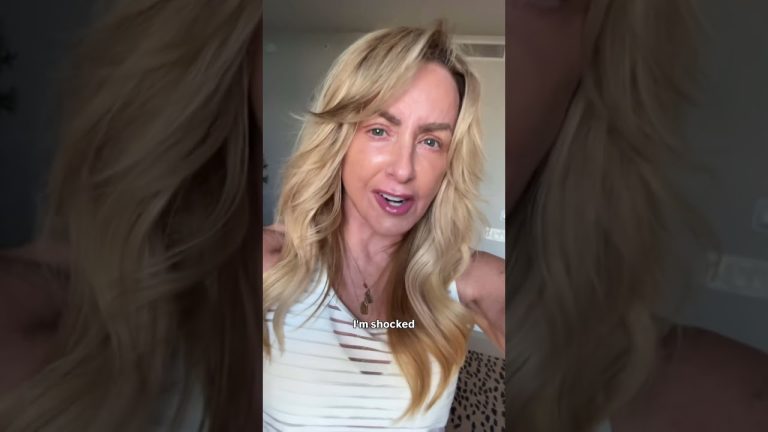 Facelift Day 8: Laser Bruise Removal?! 🤯