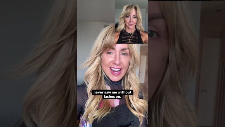 Day 11 Post-Facelift: Eye Reveal + Swelling Update 👀