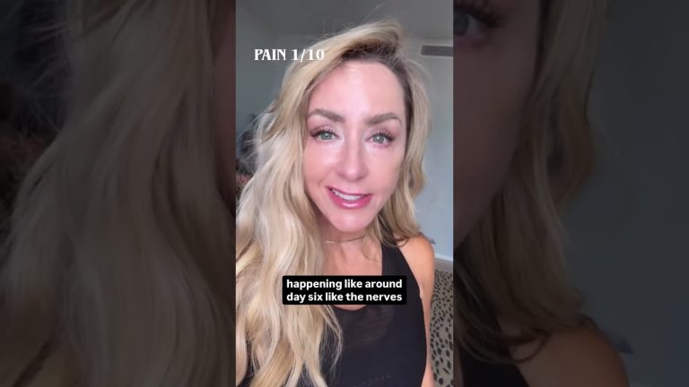 Facelift Pain Is Not What I Expected