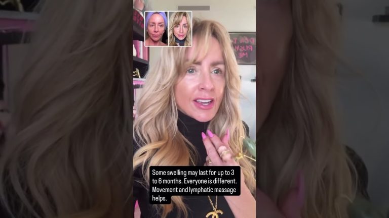 Day 12 Post-Facelift: Surgeon Removes Stitches & Shares Massage Tip