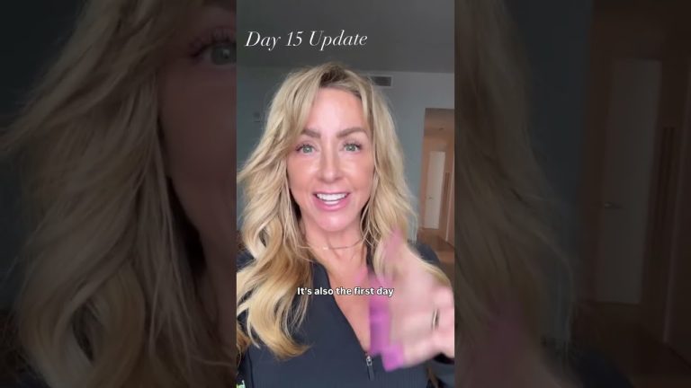 Day 15 Post-Facelift: Swelling Going Down & Cheekbones Returning!