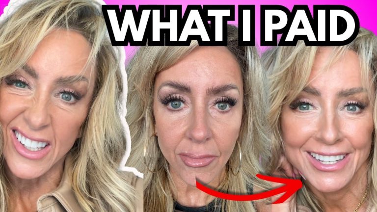 The Surgeon Who Did My Facelift Tells the Truth